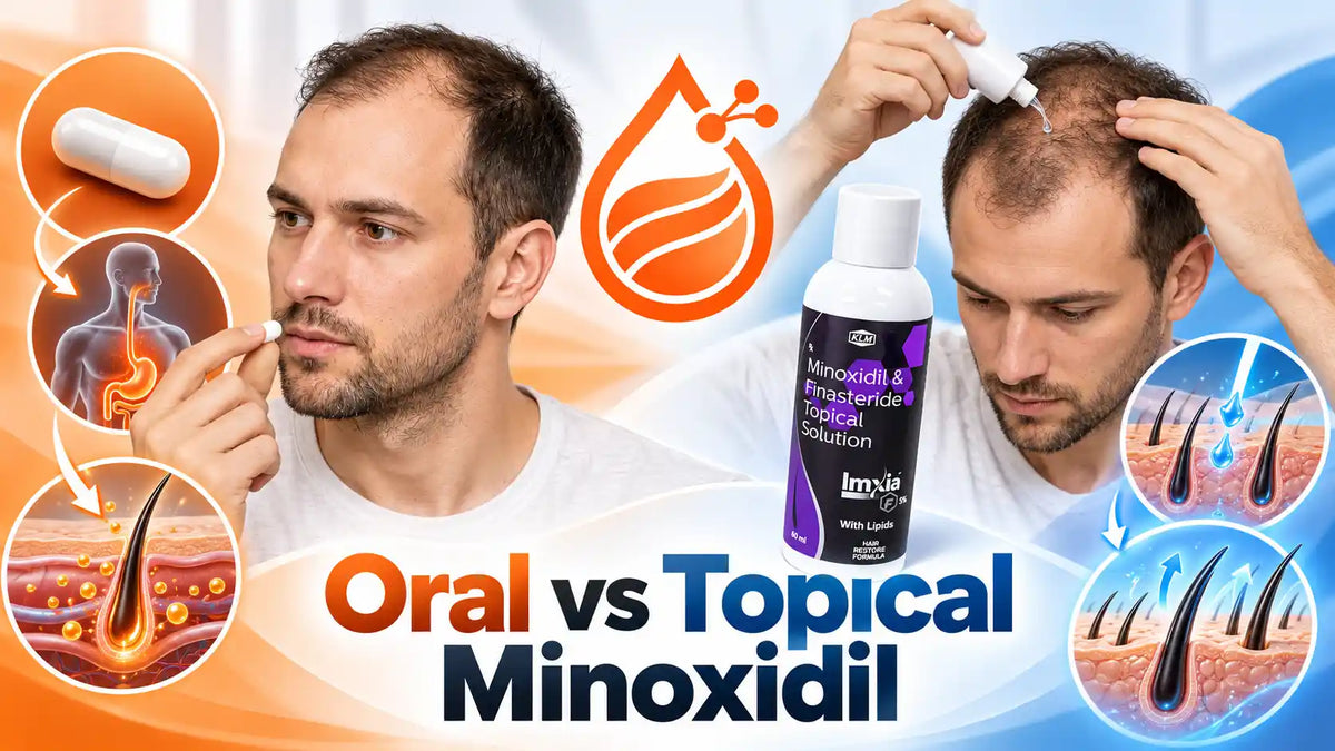 Oral vs Topical Minoxidil for Scalp Tolerance and Systemic Effects
