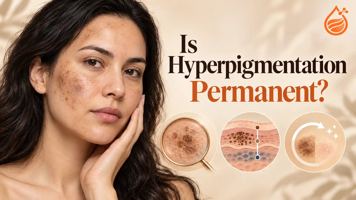 Why Hyperpigmentation Persists: Dermal Pigment and Clearance
